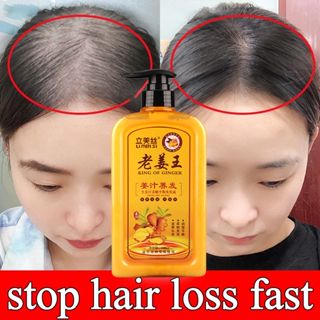 Hair Growth Ginger Shampoo Anti-Hair Loss Anti-Dandruff